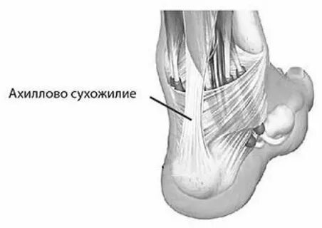 Почему рвутся сухожилия