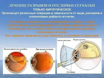 Восстановление сетчатки после операции