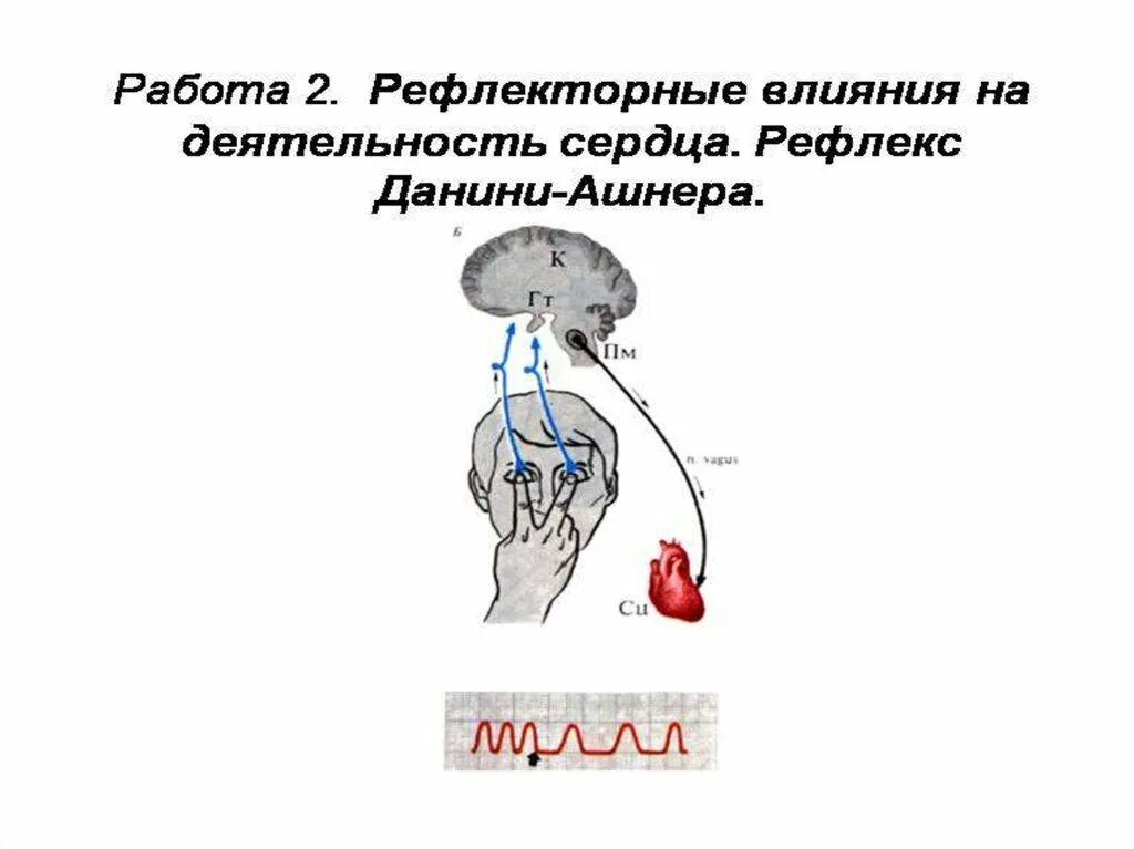 Данини Ашнера рефлекс механизм. Дуга рефлекса Даньини Ашнера. Рефлекс гольца физиология. Схема рефлекторной дуги рефлекса Даньини Ашнера.