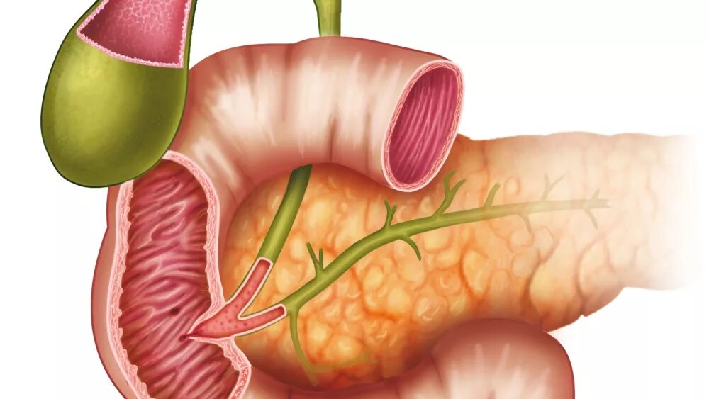 Поджелудочная железа сфинктер Одди. Поджелудочная железо сфенктер Одди. 12 Перстная кишка и сфинктер Одди. Сфинктер Одди поджелудочная анатомия.