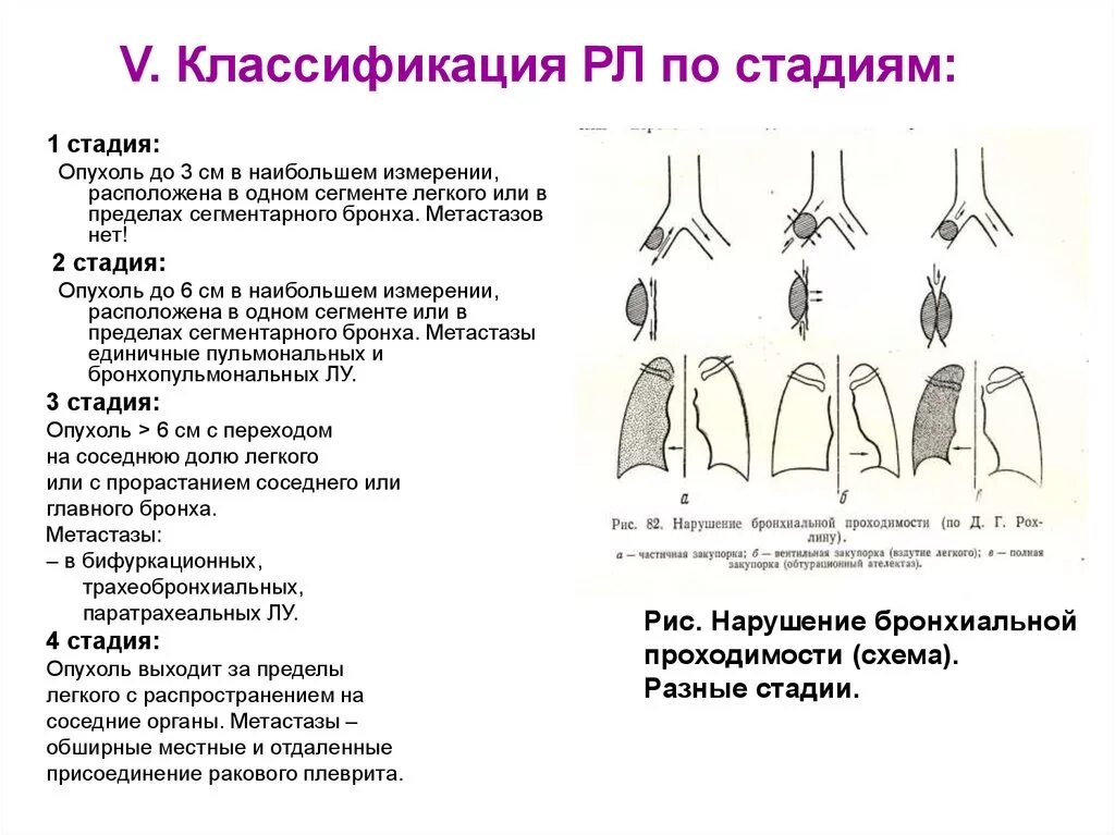 Стадии рака бронха. Классификация степеней онкологии легкого. Размеры опухоли легких по стадиям. Формы новообразования легких. Гистологическая классификация опухолей легкого.