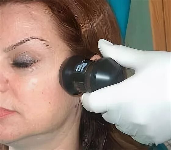 Фонофорез лидазы. Уз фонофорез. Милта физиотерапия. Аппарат милта физиотерапия. Метод лекарственного электрофореза.