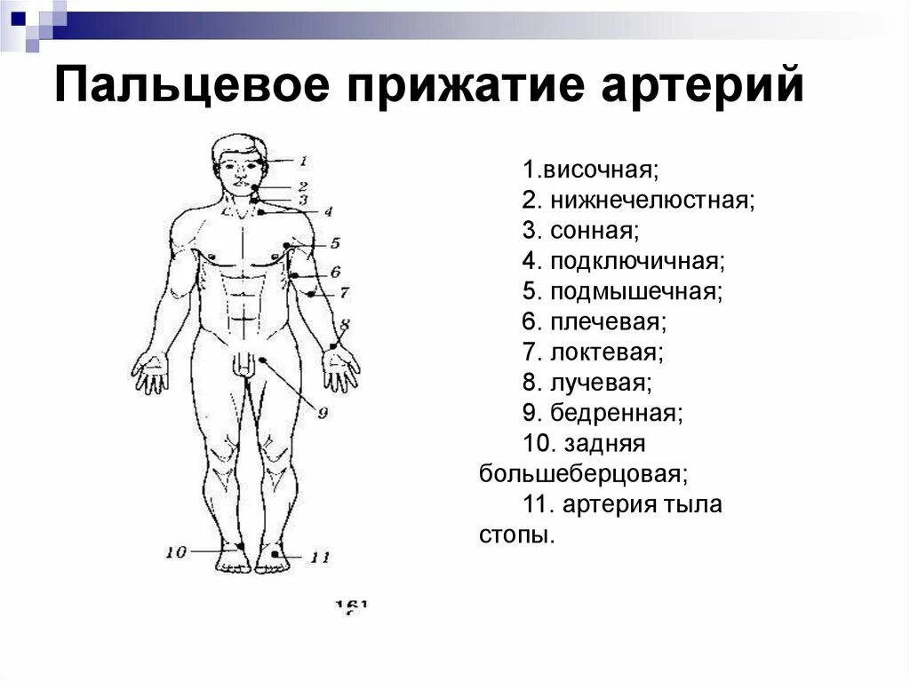 Способы остановки кровотечения пальцевое прижатие артерии. Техника пальцевого прижатия артерии. Точки прижатия артерий схема. Техника пальцевого прижатия артерии при кровотечении. Схема точек пальцевого прижатия.