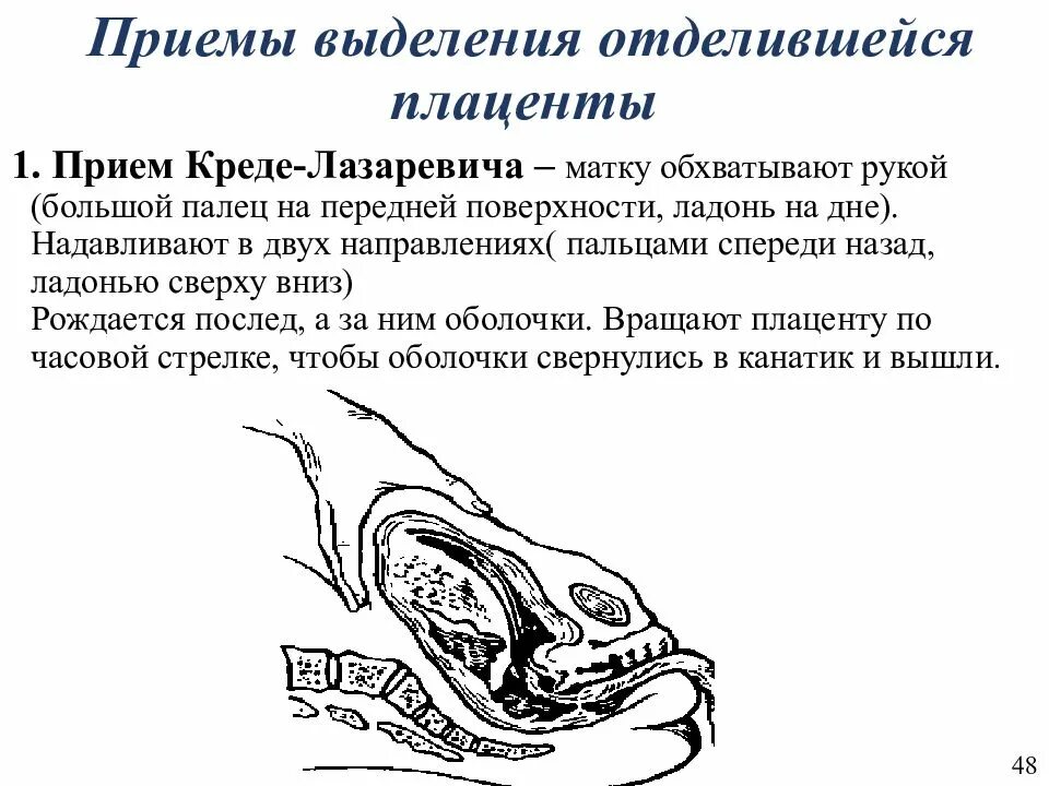 Метом это. Методы выделения отделившегося последа Креде Лазаревич. Методы выделения последа Абуладзе. Приемы Абуладзе, Гентера, Креде-Лазаревича. Способы выделения последа (Абуладзе, Креде-Лазаревича, Гентера).