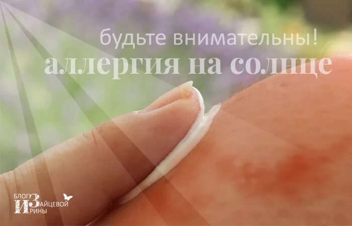 Как выглядит аллергия на солнце. Аллергия на солнце какие таблетки помогут