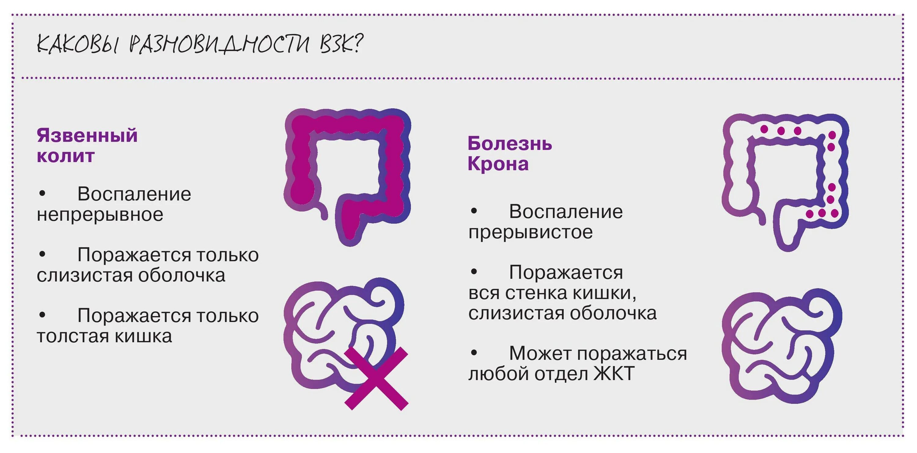 Заболевание кишечника симптомы и лечение у женщин