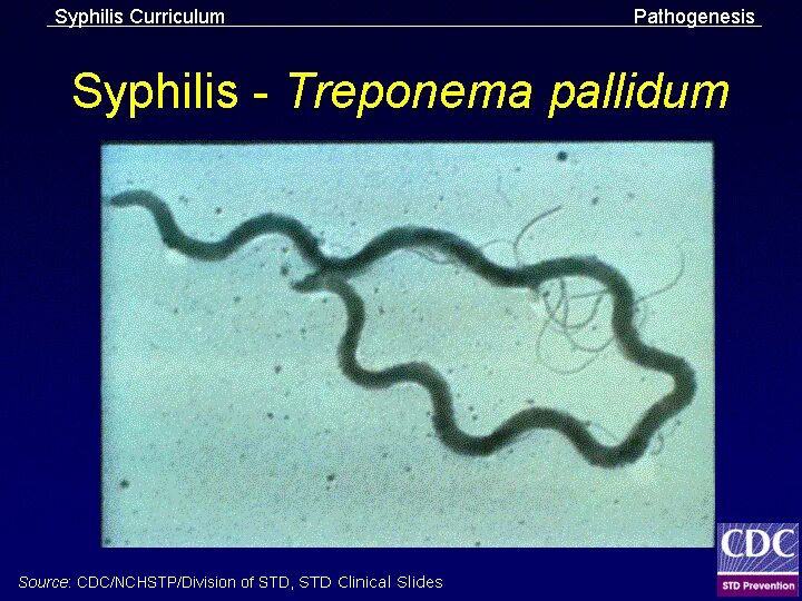 Бледная трепонема treponema pallidum. Антигены трепонемы паллидум. Возбудитель сифилиса трепонема.