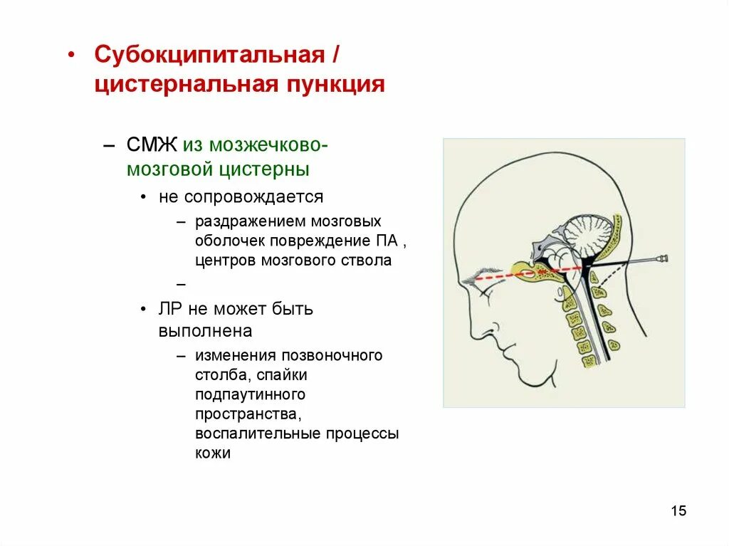 Как берут пункцию мозга. Пункция мозжечково-мозговой цистерны. Пункция вентрикулярная люмбальная субокципитальная. Пункция большой цистерны головного мозга. Люмбальная пункция головного мозга.