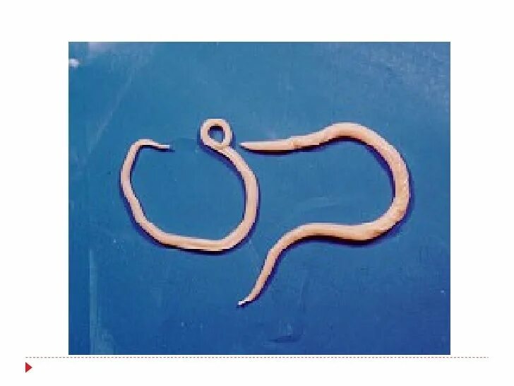 Аскариды крупные. Аскарида человеческая ascaris lumbricoides. ascaris lumbricoides морфология. самка аскариды человеческой.