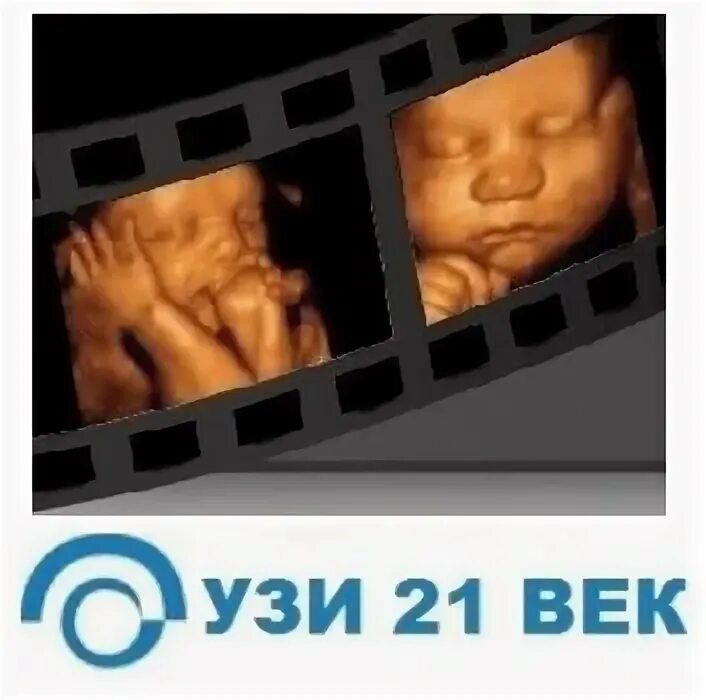 Клиника на нарвской гинекология. Узи центр петрозаводск варламова 39. Узи 21 век спб ольховая. Узи 21 век на стачек. Коханенко татьяна владимировна.