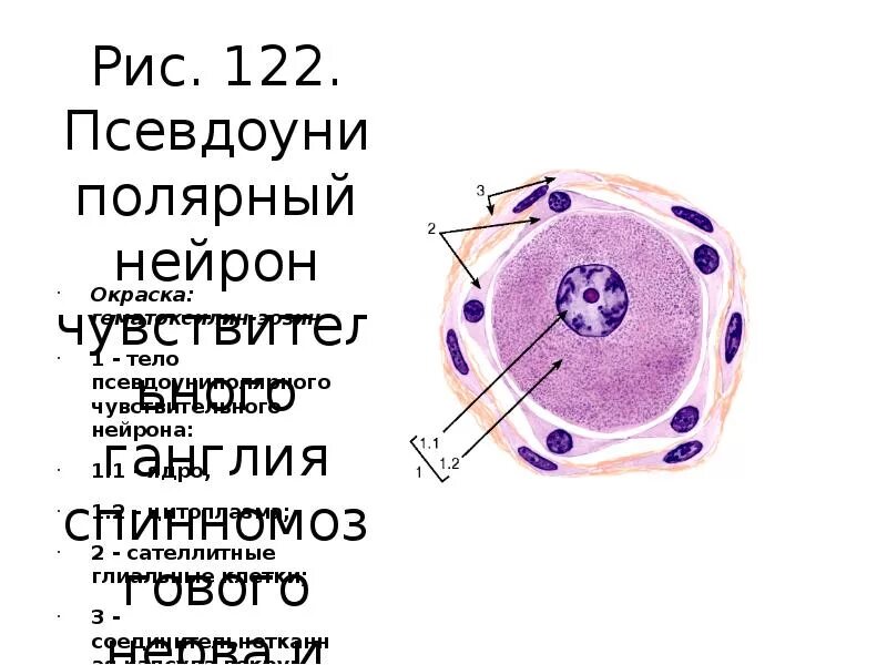 Клетки спинномозгового узла. Псевдоуниполярные Нейроны спинномозгового узла. Псевдоуниполярные Нейроны препарат. Псевдоуниполярные Нейроны спинального ганглия препарат. Нервные клетки межпозвоночного ганглия препарат гистология.