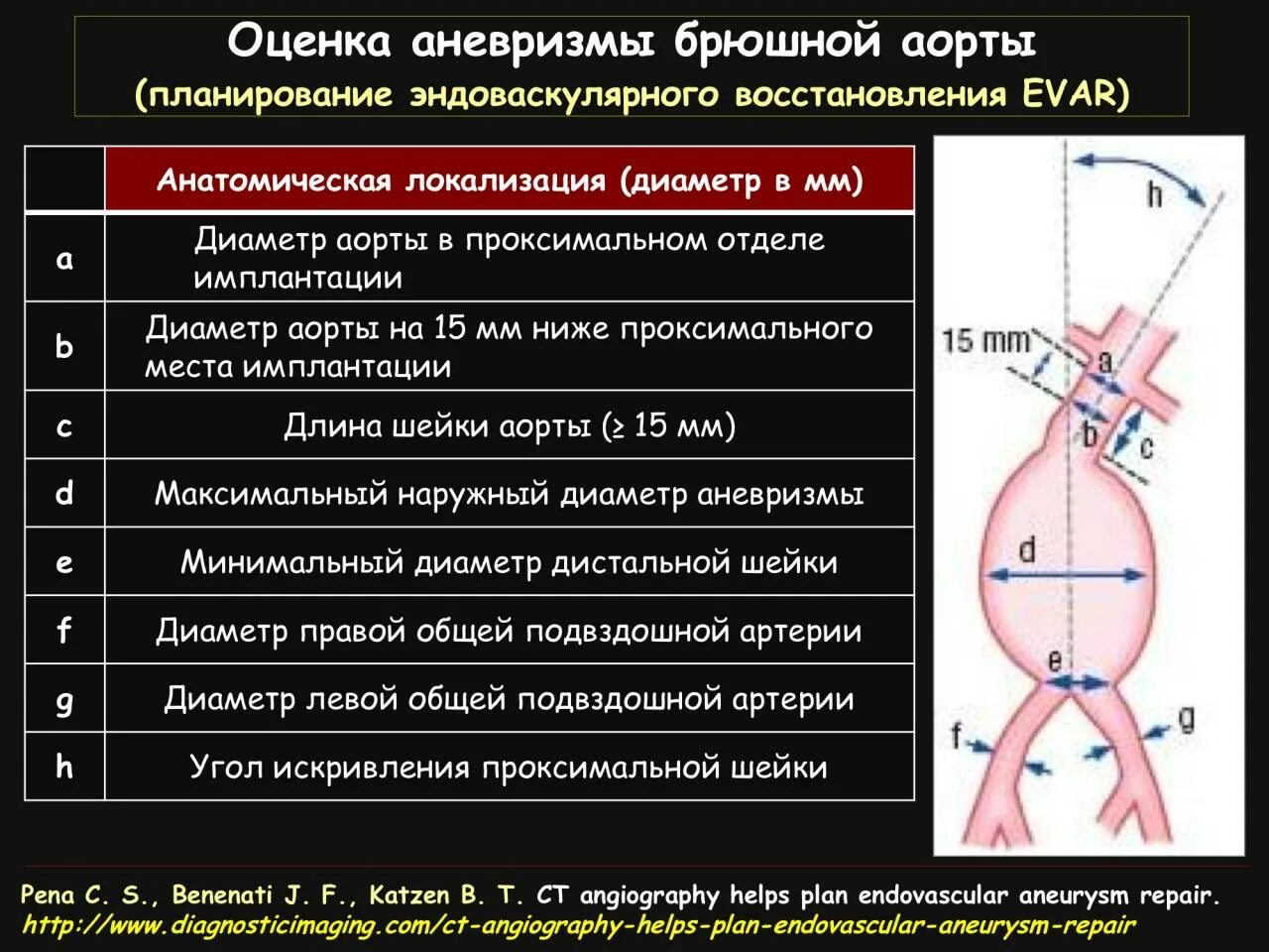 Синусы аорты норма. Синусы аорты норма