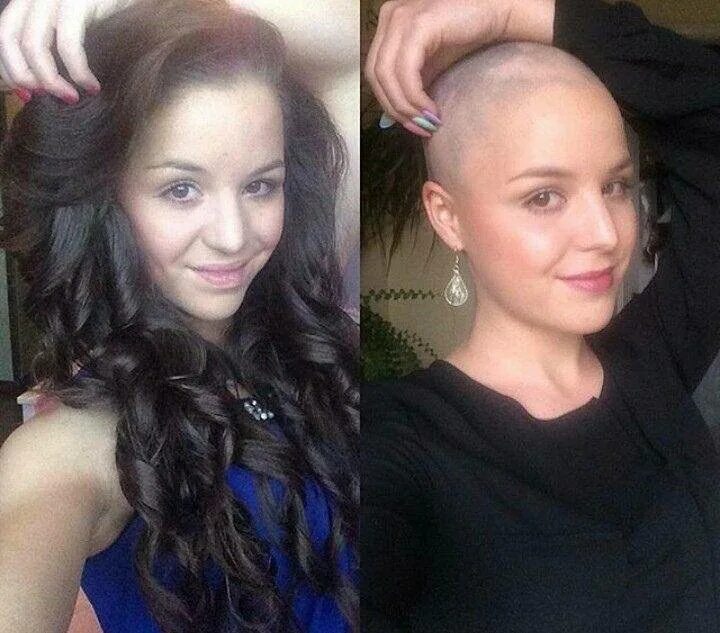 Волосы после химиотерапии. Лысые девушки до и после. Лысая стрижка до и после. Волосы после стрижки налысо.