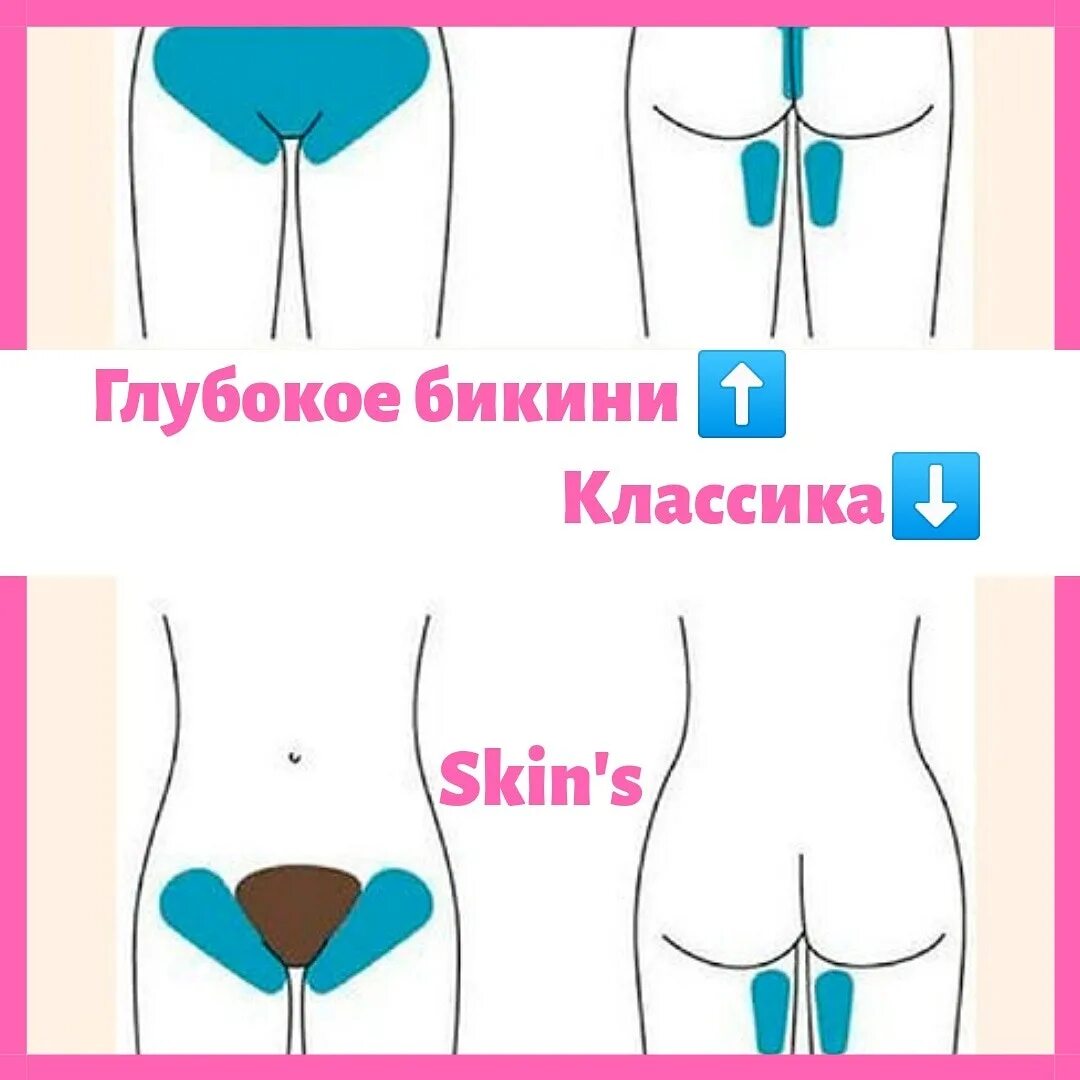 Чем отличается глубокое бикини от классического. Тотальное бикини. Глубокое бикини и классическое бикини. Классическое и глубокое бикини. Зона классического бикини.