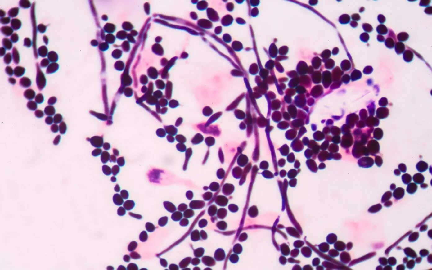 Строение гриба candida albicans. Candida albicans псевдомицелий. Псевдомицелий кандида. Псевдомицелий кандида. Грибы рода кандида микробиология.