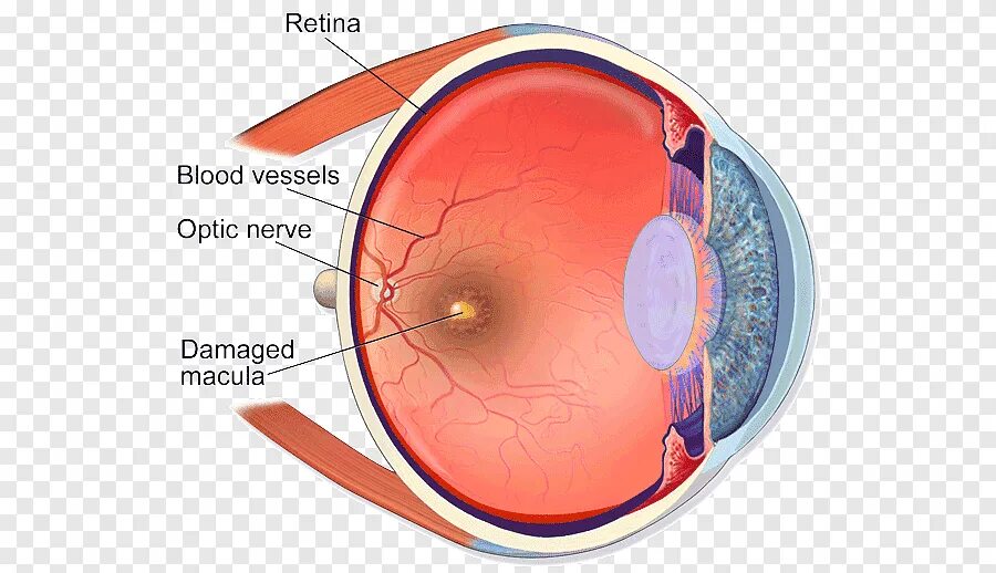 Макула и фовеа. Фовеа находится в сетчатке в середине. Вивьен фовеа. Фовеа и фовеола. Субтотальный гемофтальм.