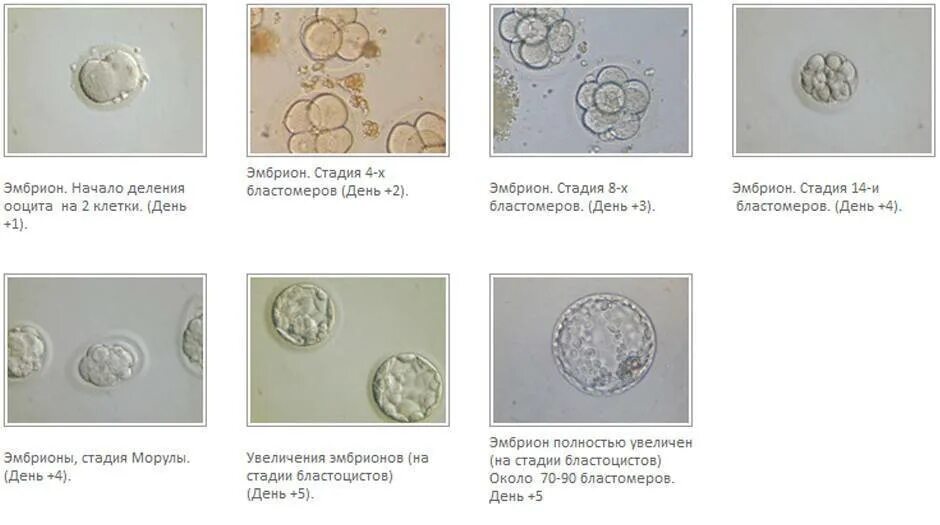 Сколько эмбрионов форум. Этапы развития эмбриона при эко 4аа. Стадии развития бластоцисты при эко. Стадии развития эмбриона. Как выглядит эмбрион на 5 сутки развития при эко.