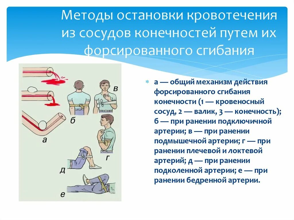 Пути остановки кровотечений. Методы окончательной остановки кровотечения хирургия. Кровотечение методы остановки кровотечения. Вид кровотечения и метод остановки кровотечения. Шунтирование метод остановки кровотечения.