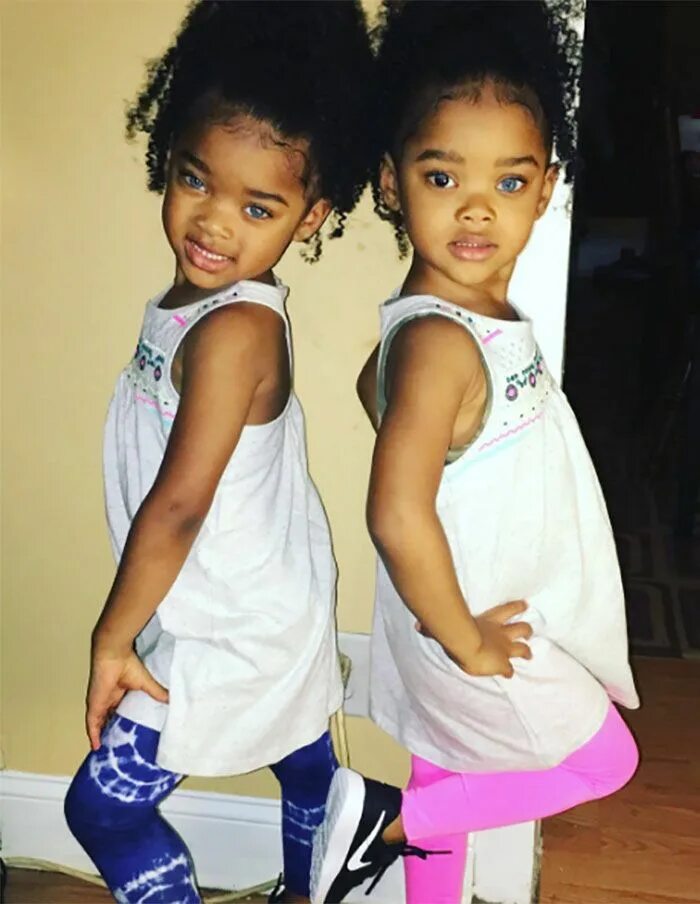 Меган и морган в детстве маленькие. Сестры меган и морган. Близняшки с разным цветом кожи. Мария и люси эйлмер сейчас 2022. Близняшки в голосе.