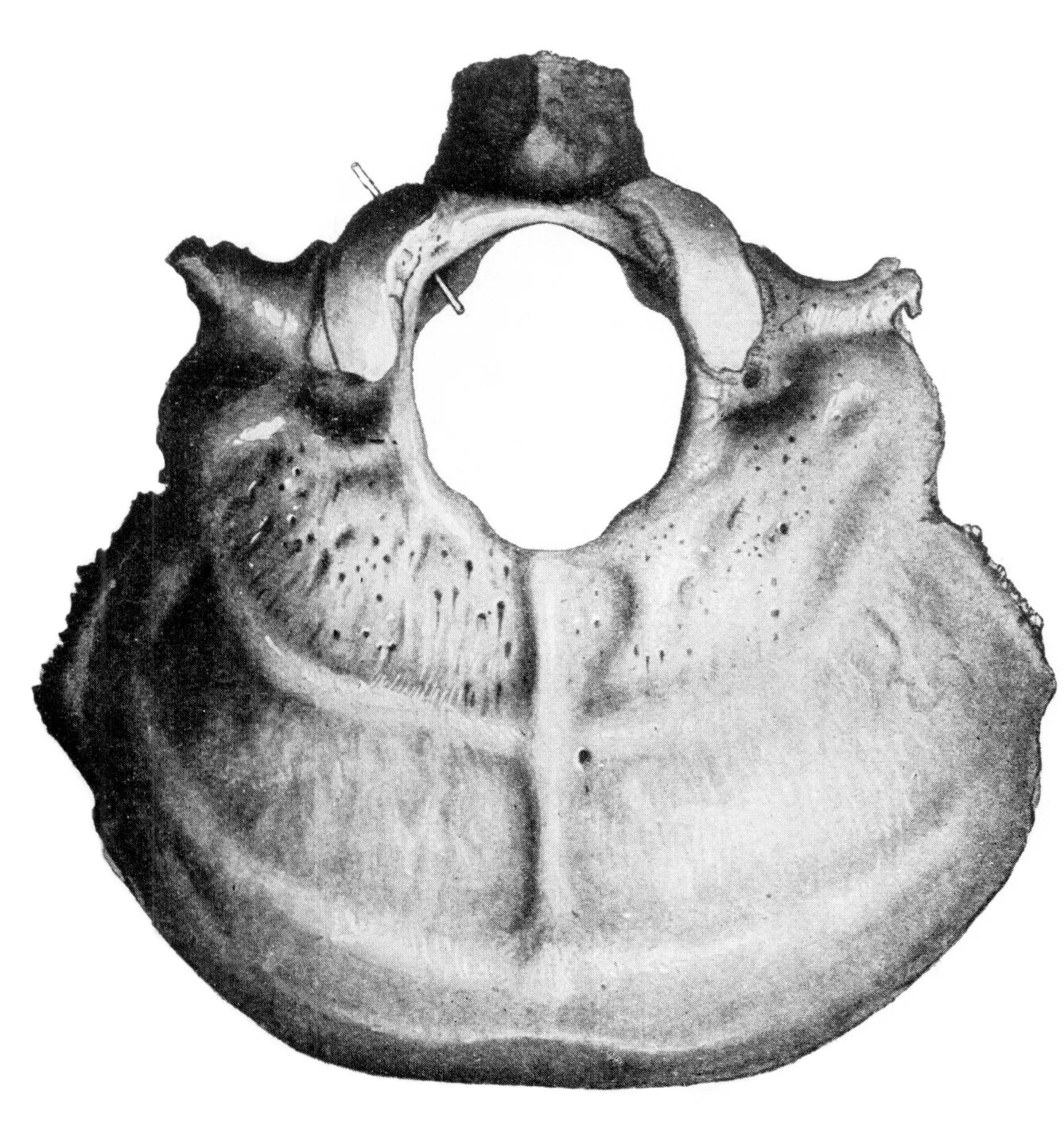 Sulcus sinus petrosi inferioris