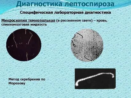 Лептоспироз диагностика