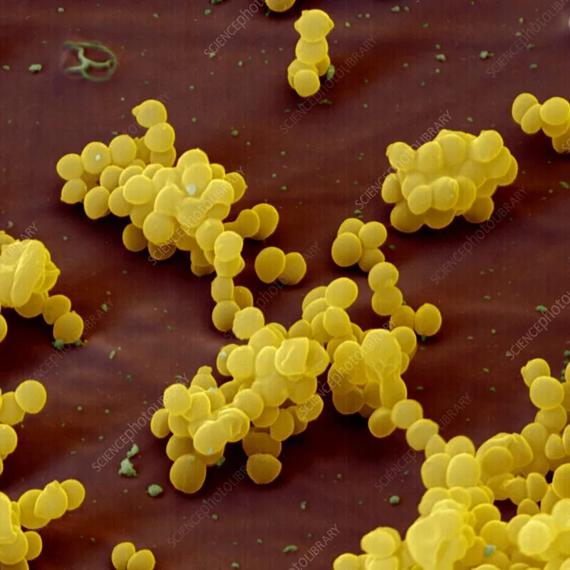 S. aureus золотистый стафилококк. Золотушный стафилококк. Стафилококк ауреус микробиология. Стрептококк ауреус.