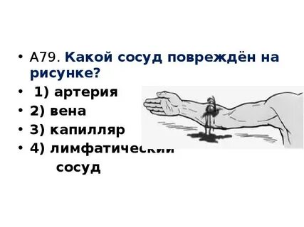 Укажите правильную последовательность сосудов