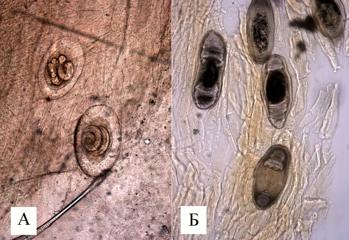 Личинка трихинеллы микроскоп. Трихинеллез микроскопия. Личинки паразитов трихинелл. Личинка трихинеллы в мышцах под микроскопом.
