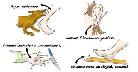 Заражение столбняком