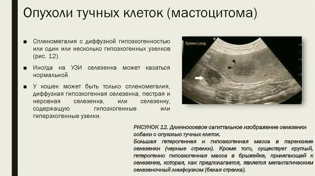 Лечение селезенки у мужчин. Ультразвуковое исследование селезенки. УЗИ селезенки. Новообразования селезенки.