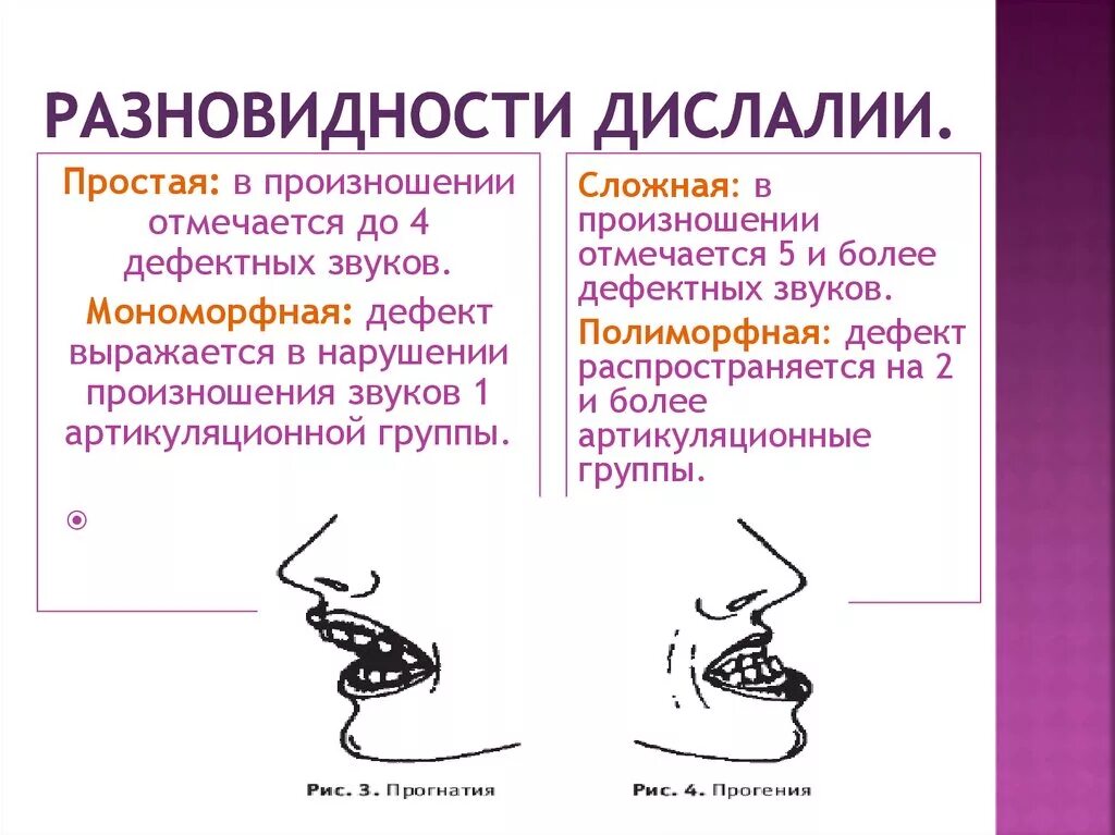 Классификация дислалии схема. Нарушения звуков при дислалии. Симптомы механической дислалии. Виды дислалии у детей. Простая дислалия