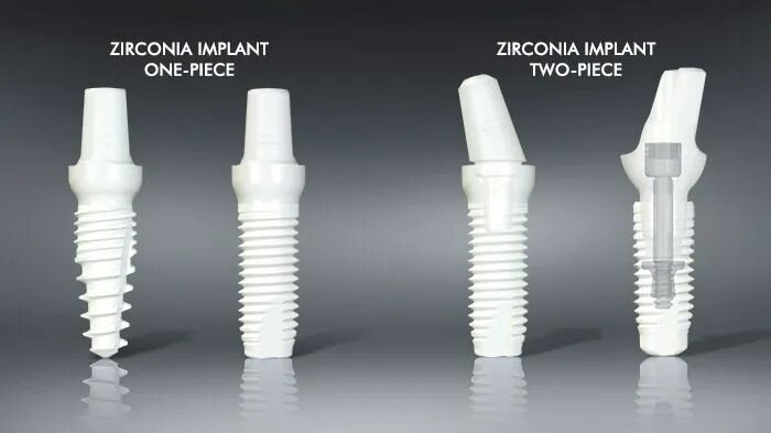 Titanium implants
