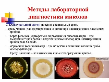 Диагностика микозов