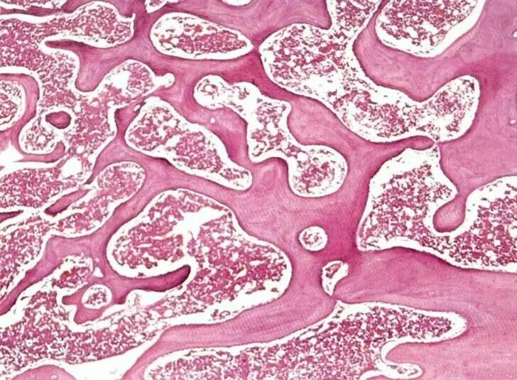 Анатомия и гистология животных. Губчатая костная ткань гистология. губчатая кость гистология препарат. ткань кости гистология.