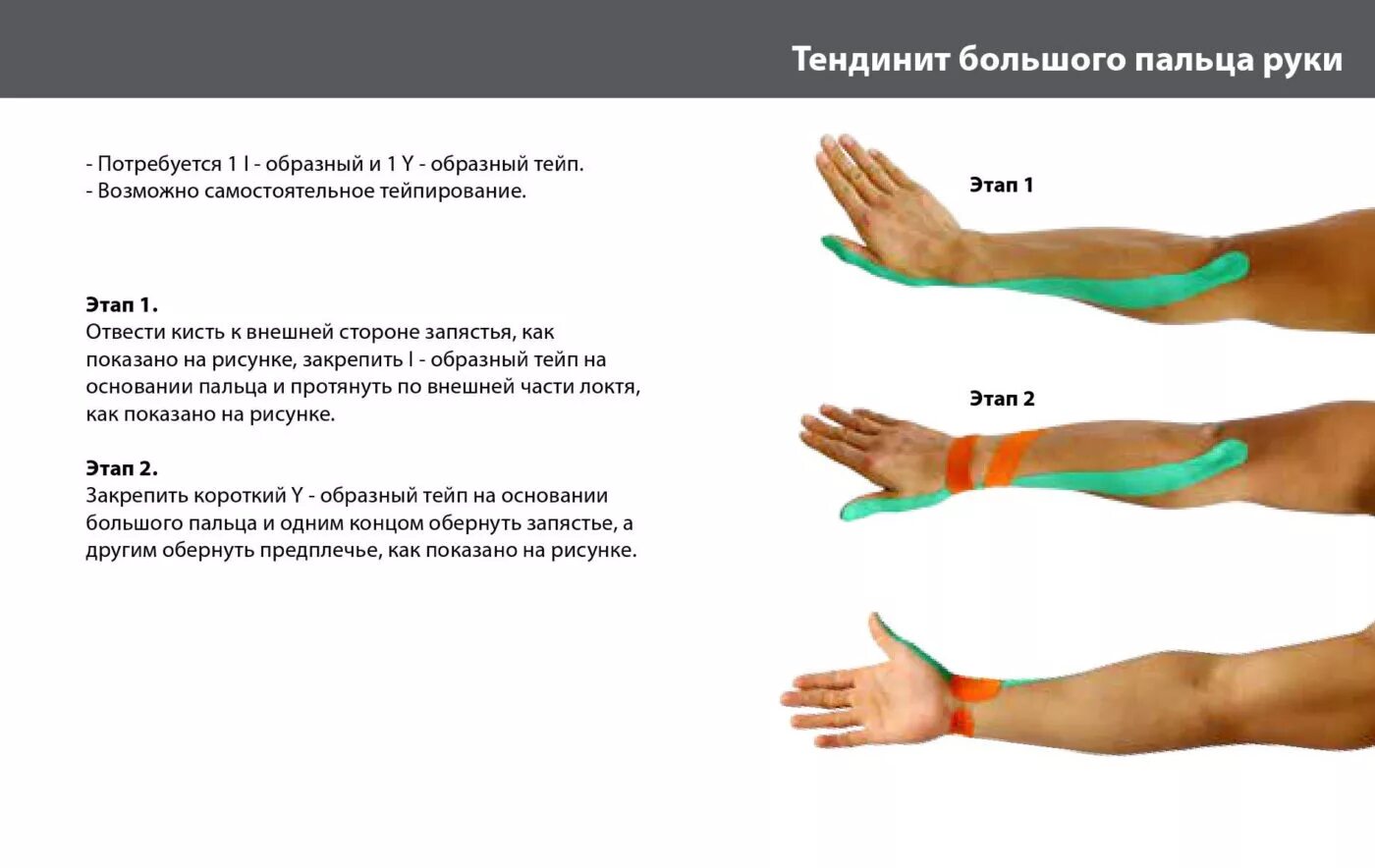 Какая рука сильнее и почему. Тейпирование запястья схема. Болезнь де Кервена тейпирование. Тейпирование запястья туннельный синдром. Тейпирование при туннельном синдроме кисти руки.