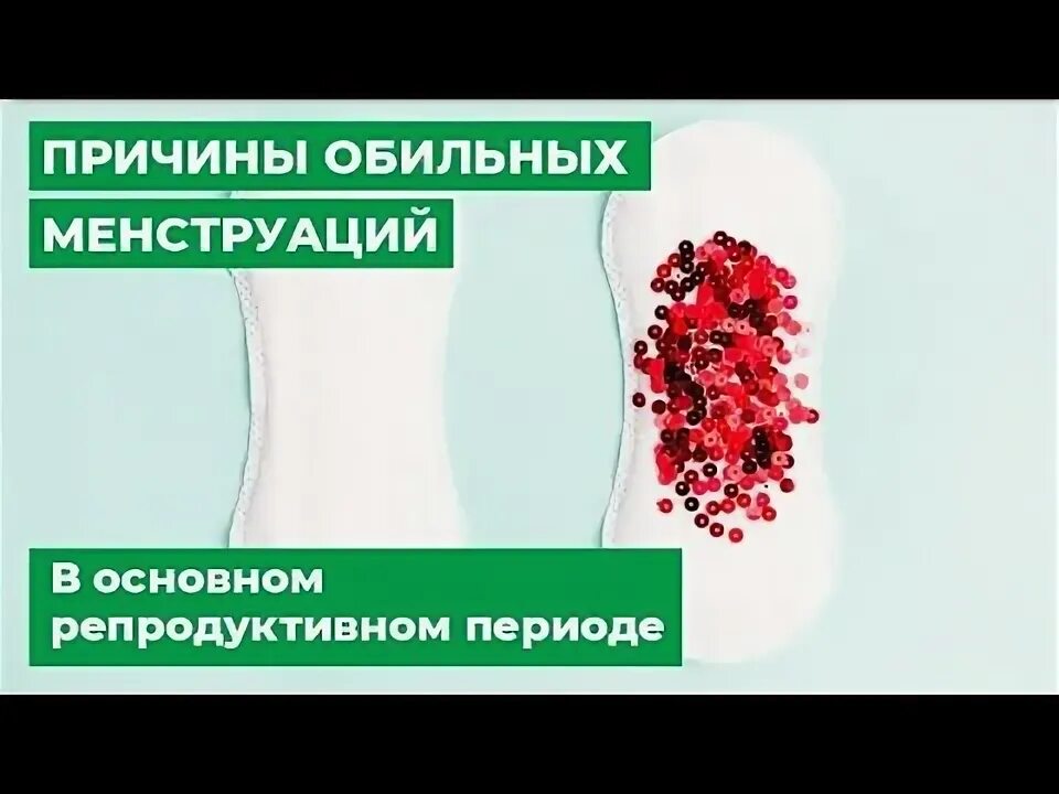 Может ли быть беременность при обильных месячных. Обильные месячные причины. причины обильных месячных. точки при обильных месячных. синдром обильных менструальных.