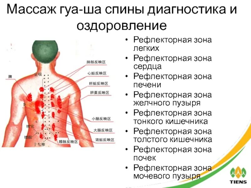 Рефлексогенные зоны сердца. Массаж спины скребком Гуаша схема. Массаж тела скребком Гуаша схема. Массаж Гуаша для спины схема. Массаж Гуаша схема направления движения.