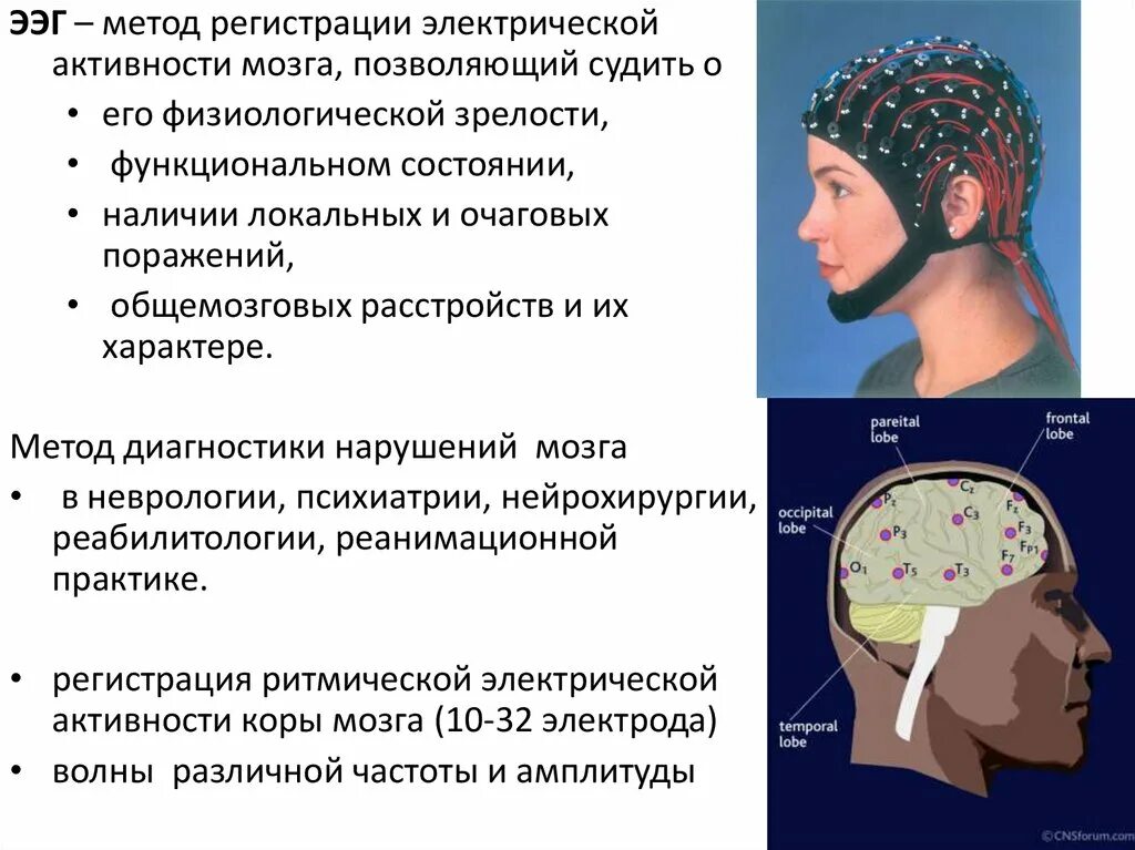 Болит шапка головы. Электроэнцефалография (ЭЭГ) метод. Исследование активности мозга. Электроэнцефалография мозга метод. Методы регистрации электрической активности мозга.