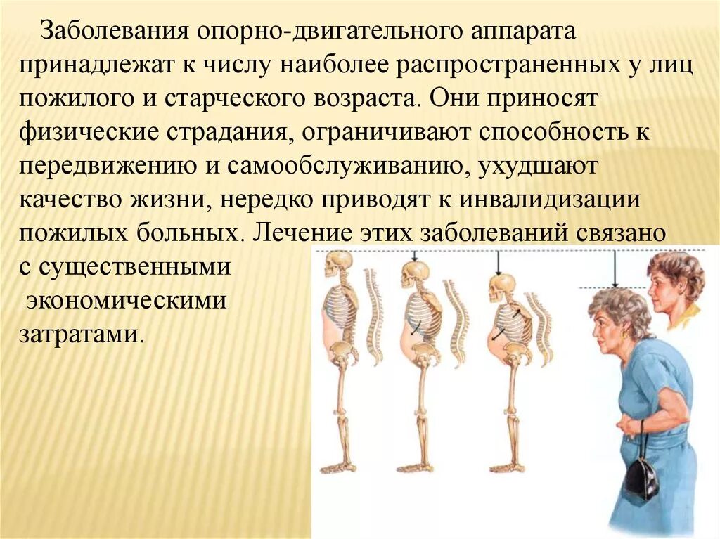 Дефект двигательного аппарата. Заболевания опорно-двигательного аппарата. опорно двигательные заболевания. профилактика нарушений опорно-двигательного аппарата. профилактика заболеваний опорно двигательной системы.