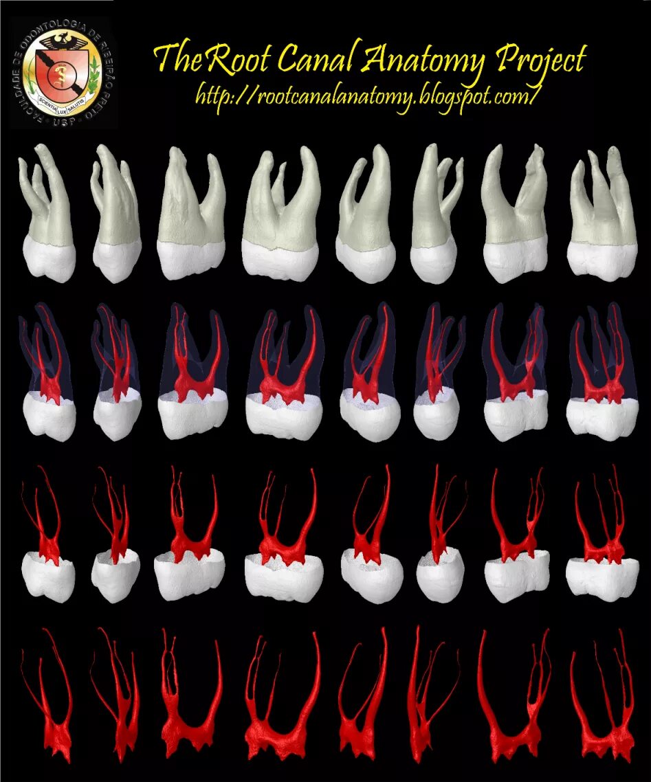 Анатомия корневых каналов 4.7. Анатомия каналов 1.7 зуба. Анатомия корневых каналов 45. 16 Зуб анатомия корневых каналов. Формы корневых каналов