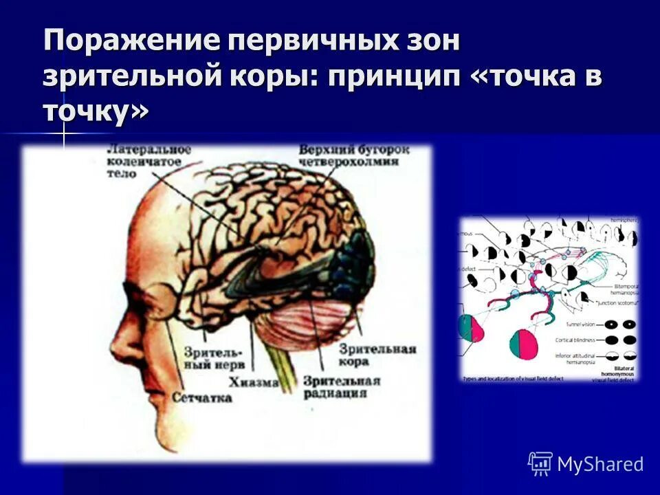 Высшие мозговые функции. Высшие мозговые функции