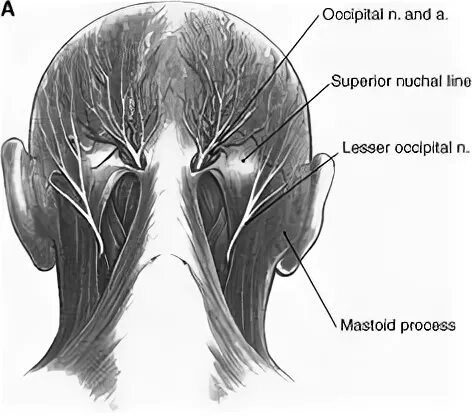 Neuralgia латынь. Neuralgia латынь