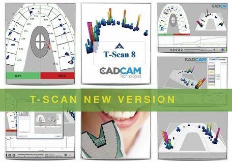 T scan