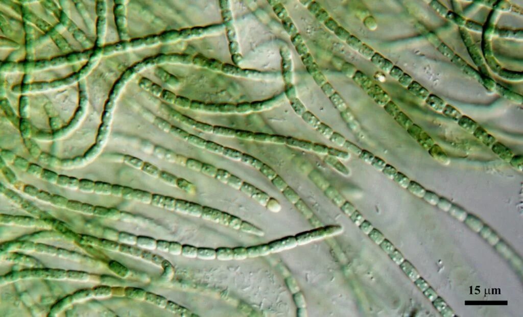 Клетка бурой водоросли. Нитчатые цианобактерии. Calothrix цианобактерия. Цианобактерии водоросли. Цианобактерии бациллы.