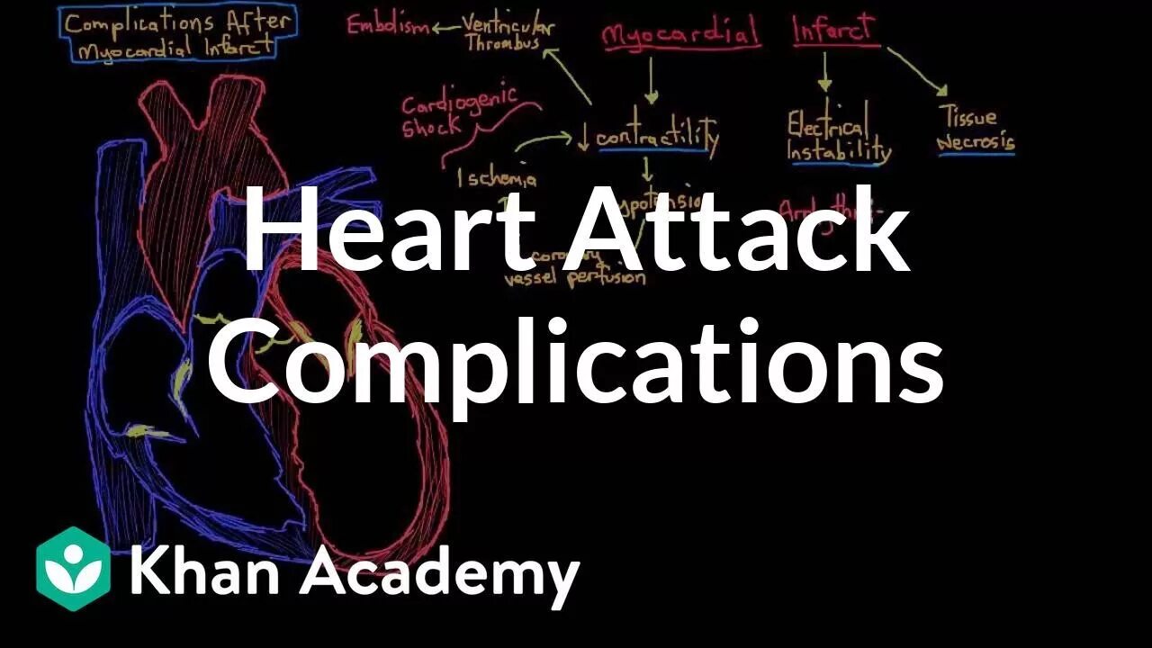 Heart attack speed up. Heart attack speed up