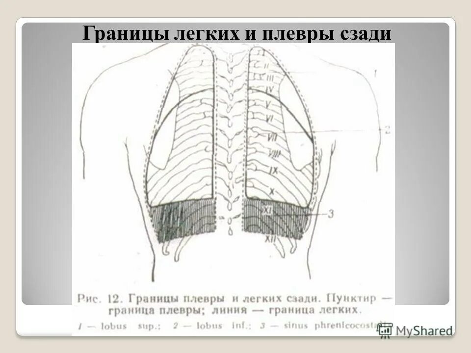 Границы легких границы плевры. Границы плевры анатомия. Скелетотопия границ легких. Скелетотопия легких и плевры. Задняя граница легких