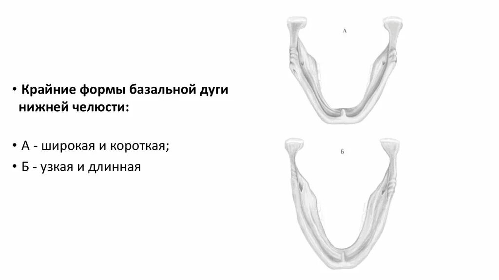 Зубочелюстные сегменты. Зубочелюстные сегменты верхней челюсти. зубочелюстные сегменты верхней и нижней челюсти. сегменты нижней челюсти. сегментация верхней челюсти.