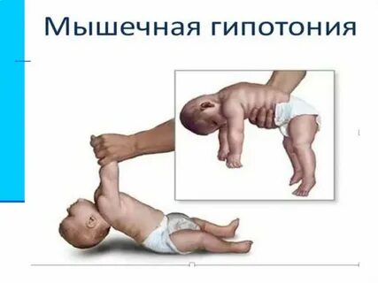 Мышечная система у детей