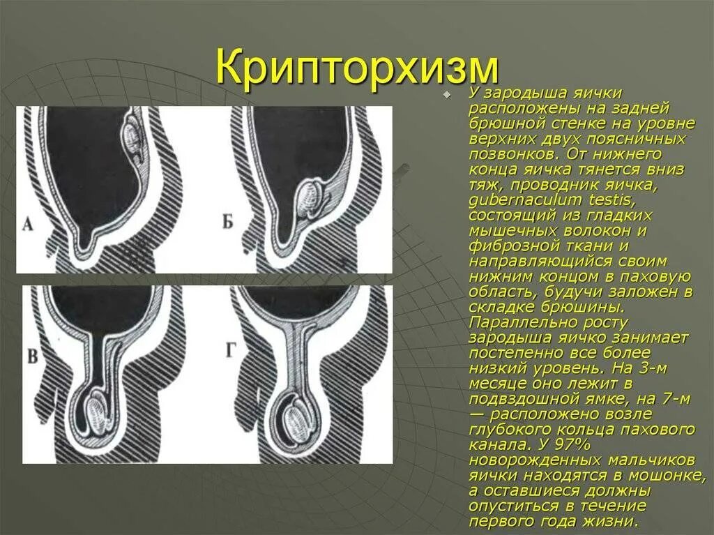 Почему яйцо уходить