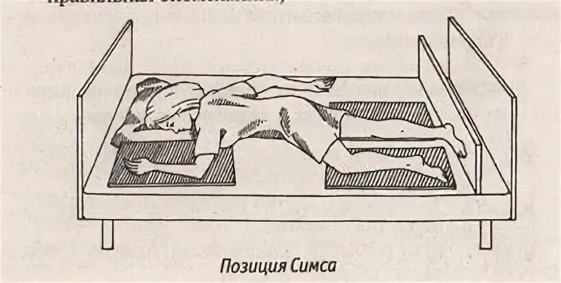 Положение Фаулера, симса и на боку. Положение пациента в постели симса. Положение пациента в постели симса Фаулера. Поза Фаулера и симса.